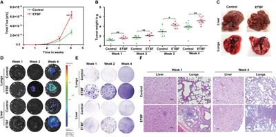 Gut colonization with an obesity-associated enteropathogenic microbe modulates the premetastatic niches to promote breast cancer lung and liver metastasis